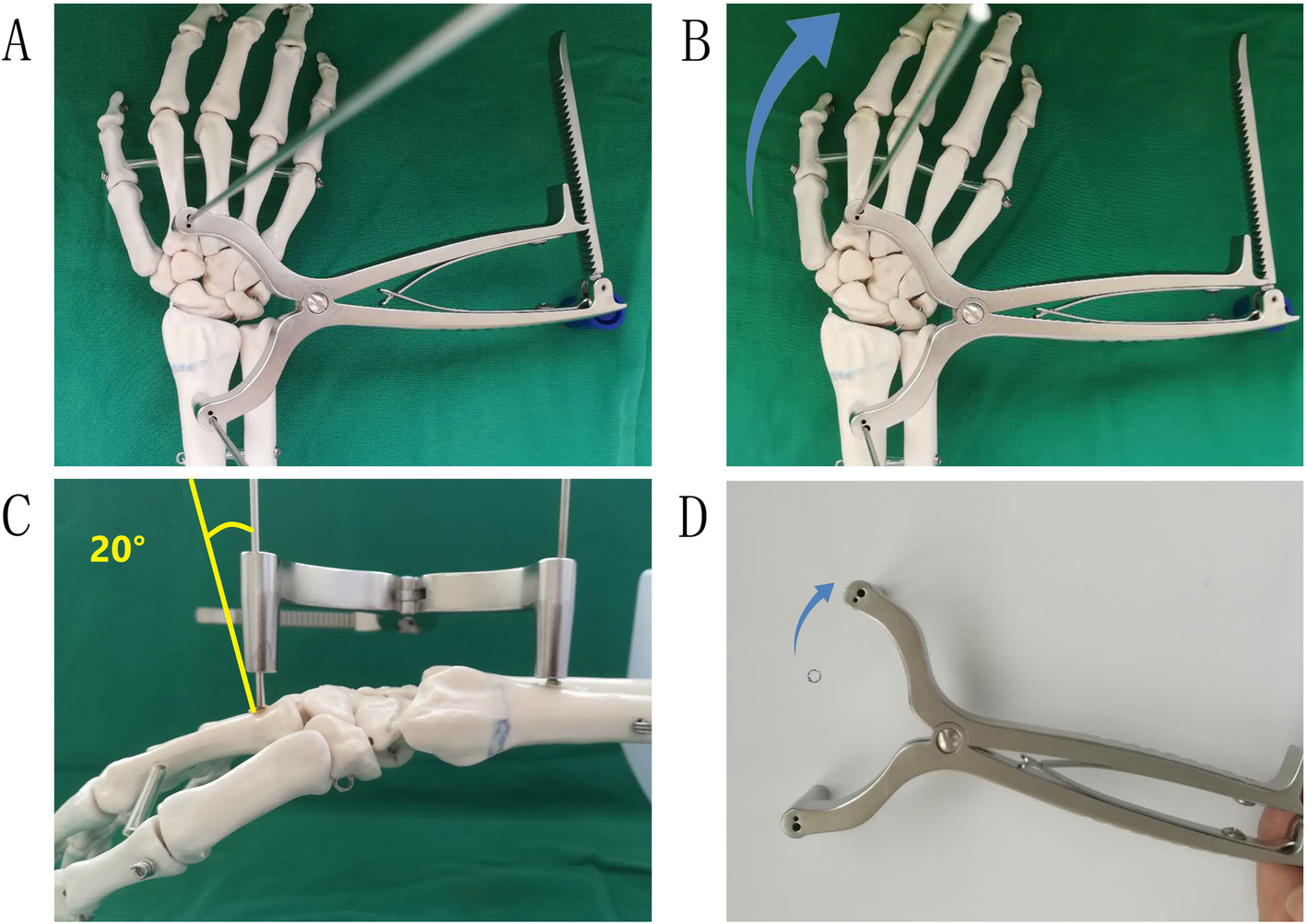 Fig. 2