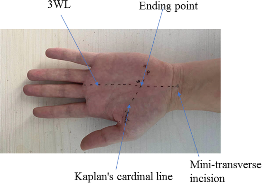 Fig. 2