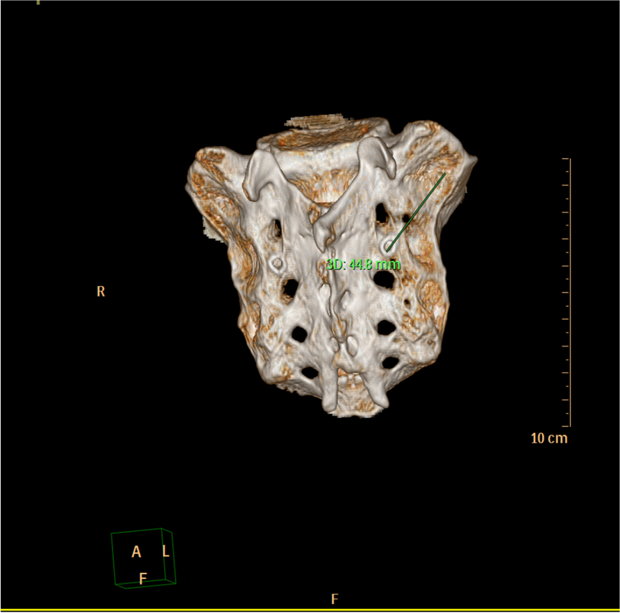 Fig. 3