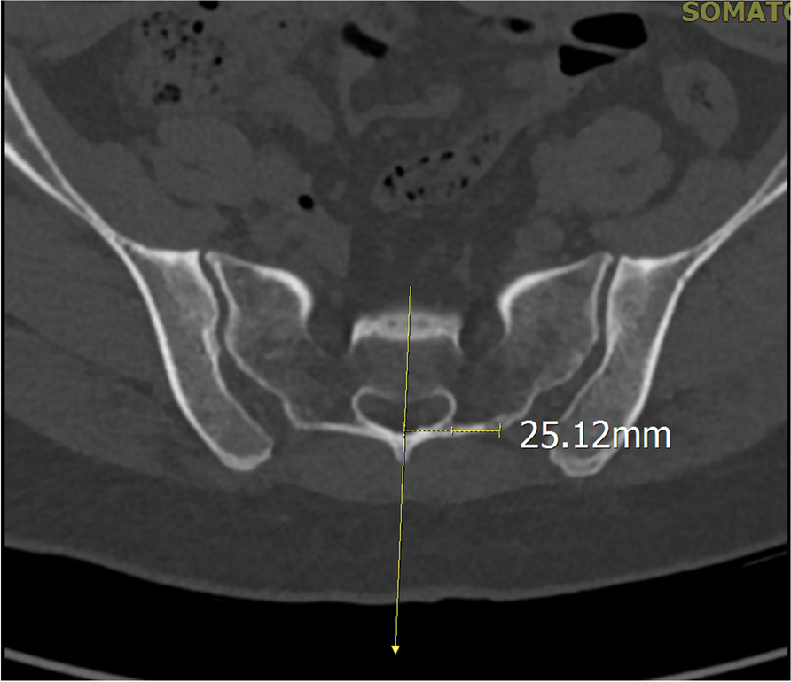 Fig. 6