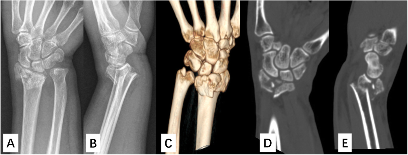 Fig. 1