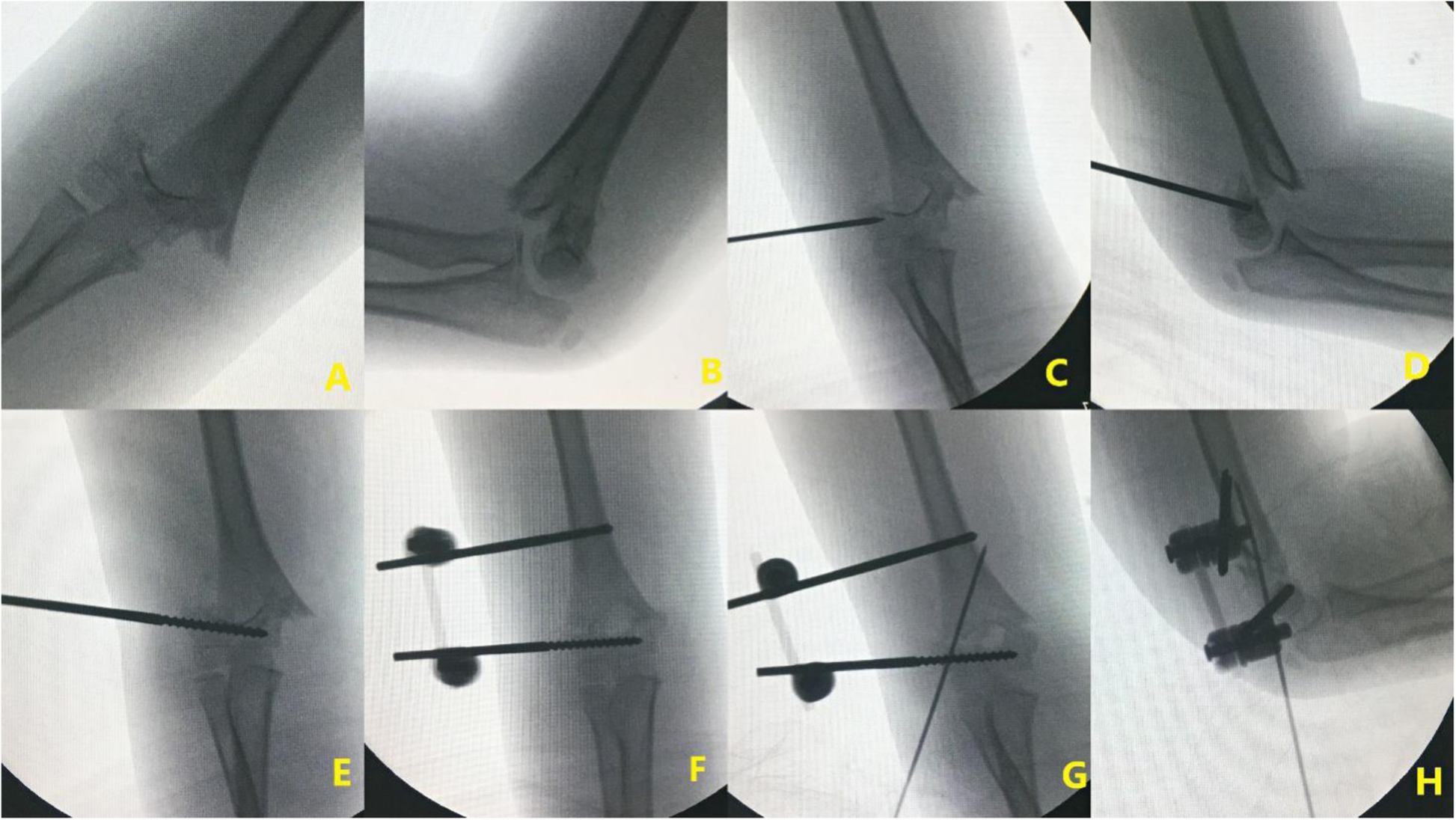 Fig. 1