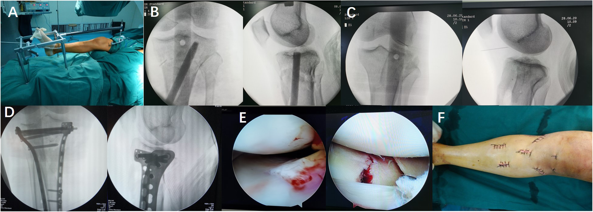 Fig. 1