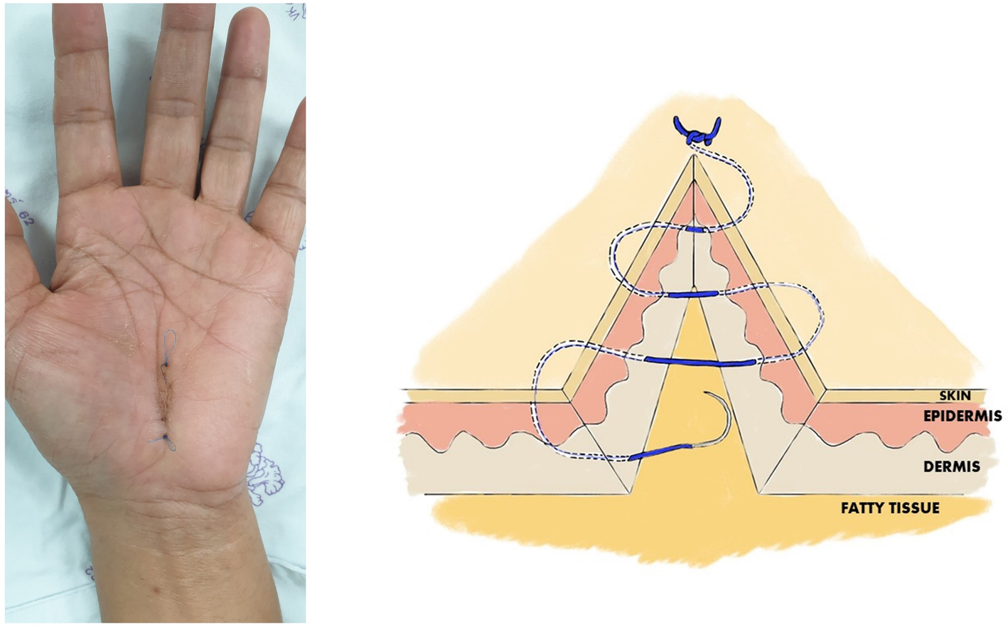 Fig. 1