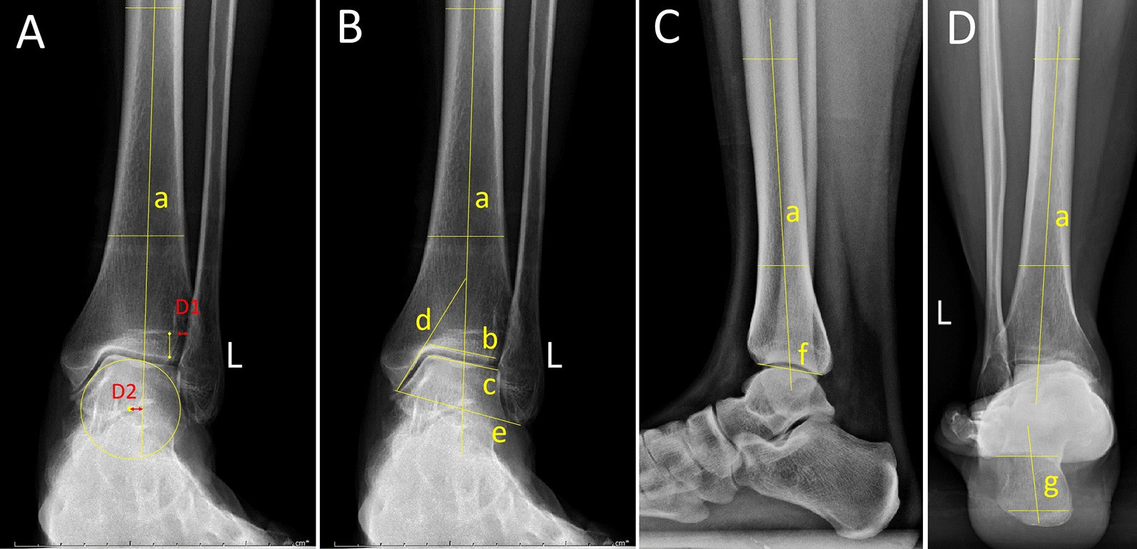 Fig. 4