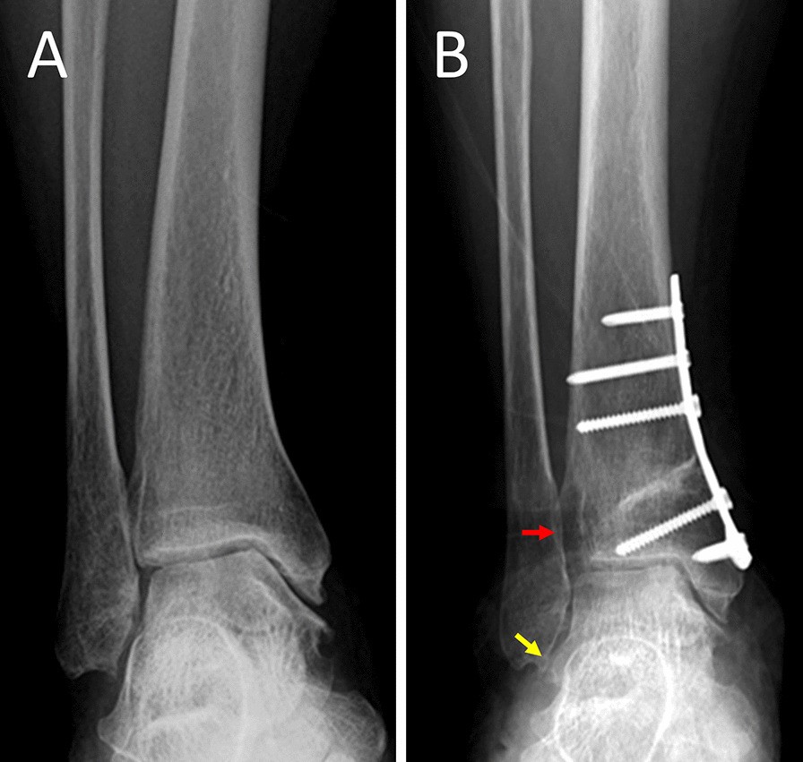 Fig. 6