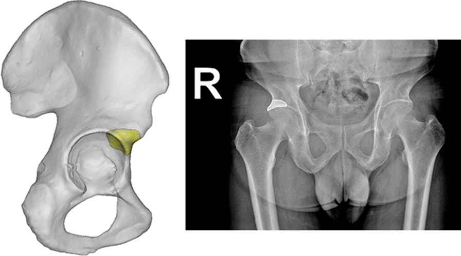 Fig. 1