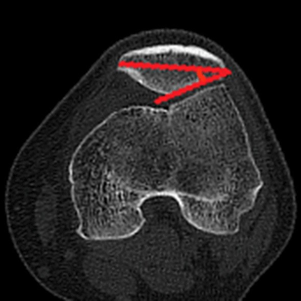 Fig. 7