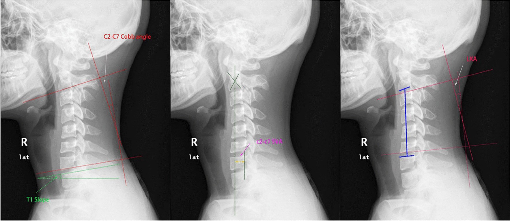 Fig. 2