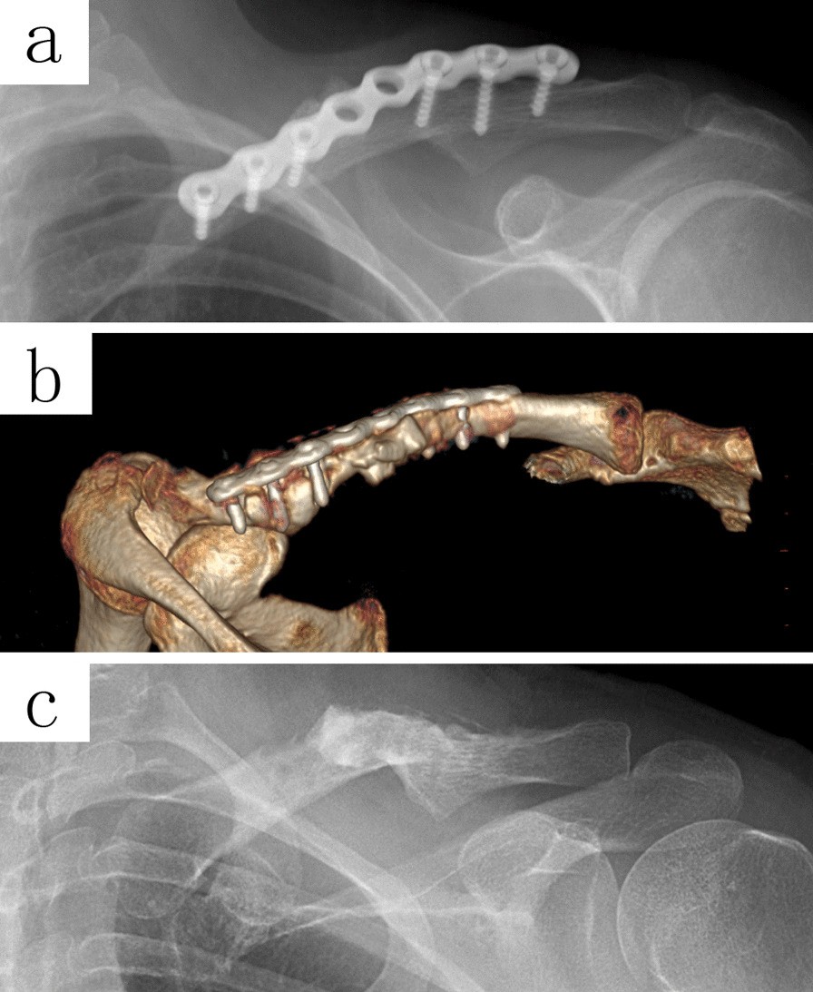 Fig. 5