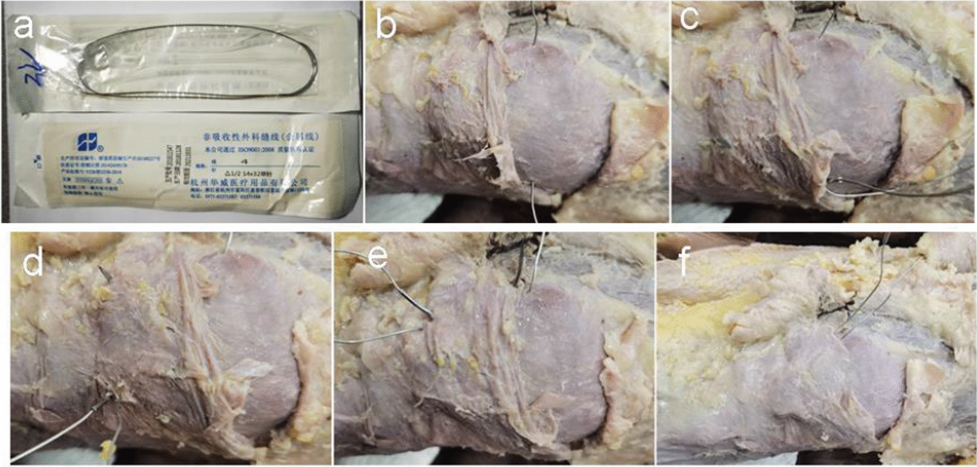 Fig. 2