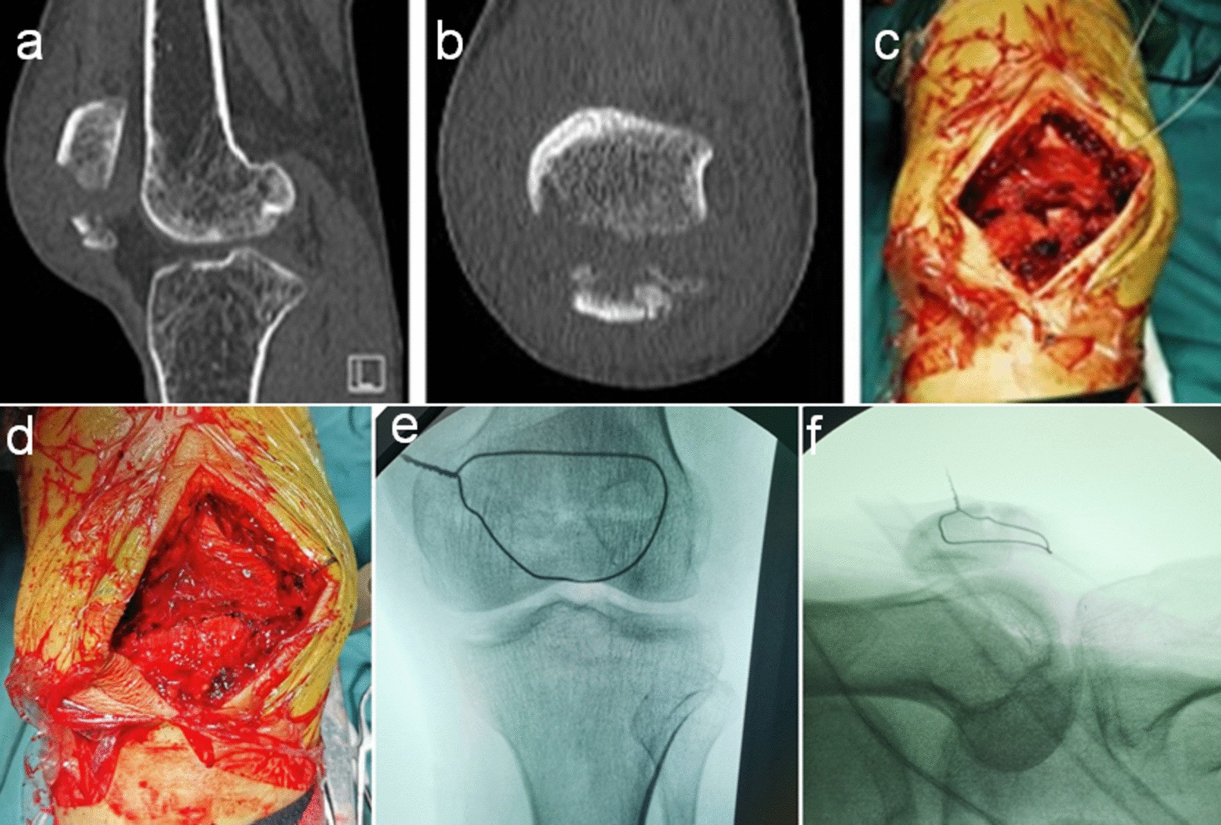 Fig. 3