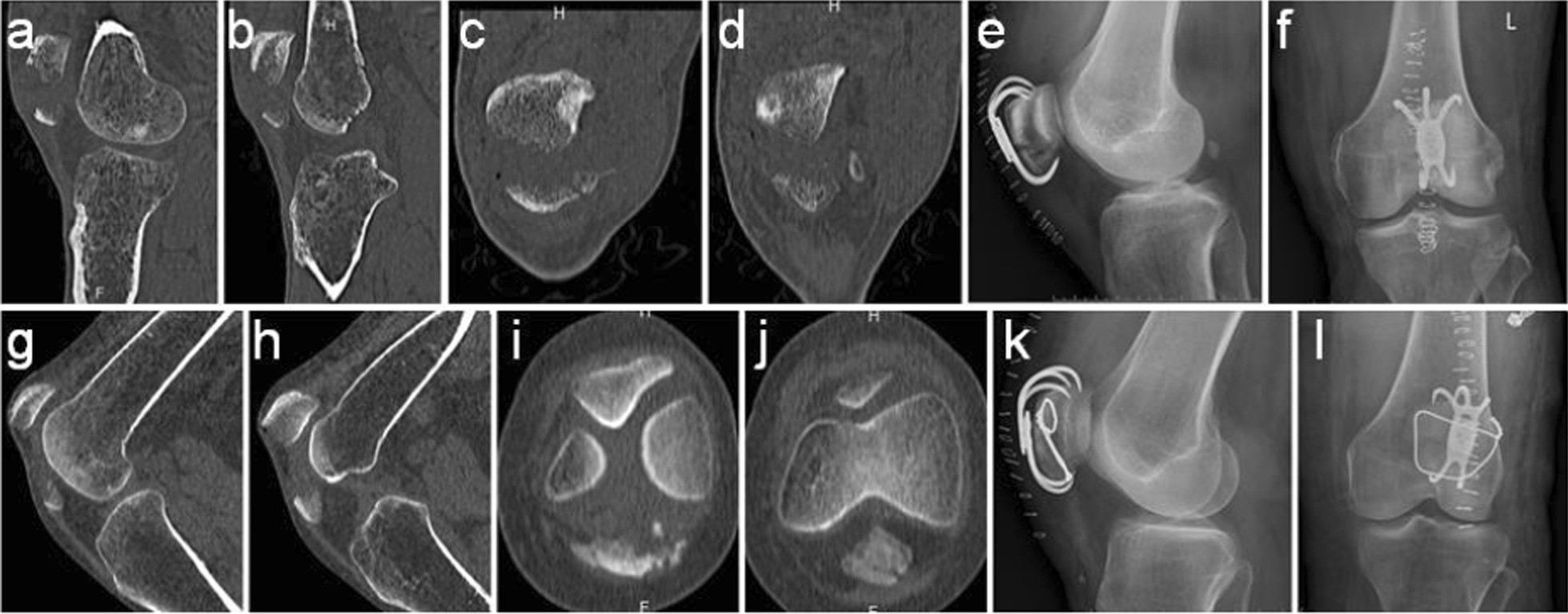 Fig. 4