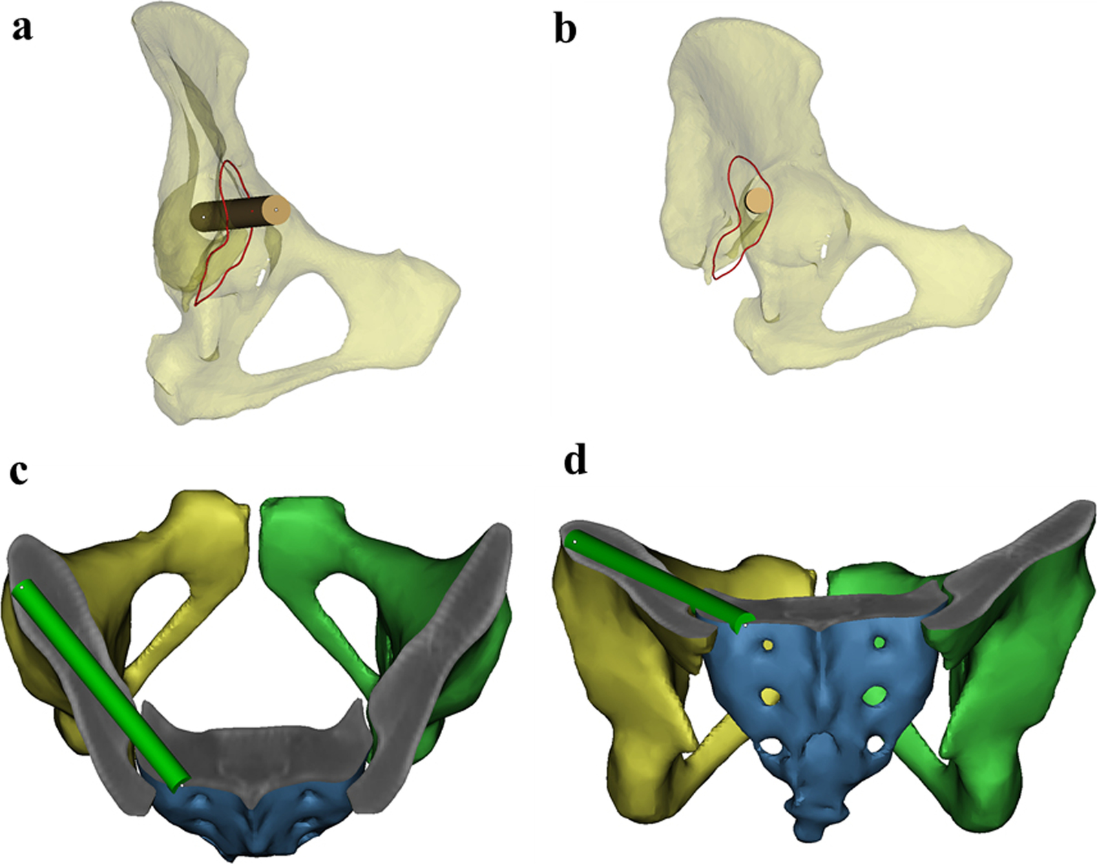 Fig. 4