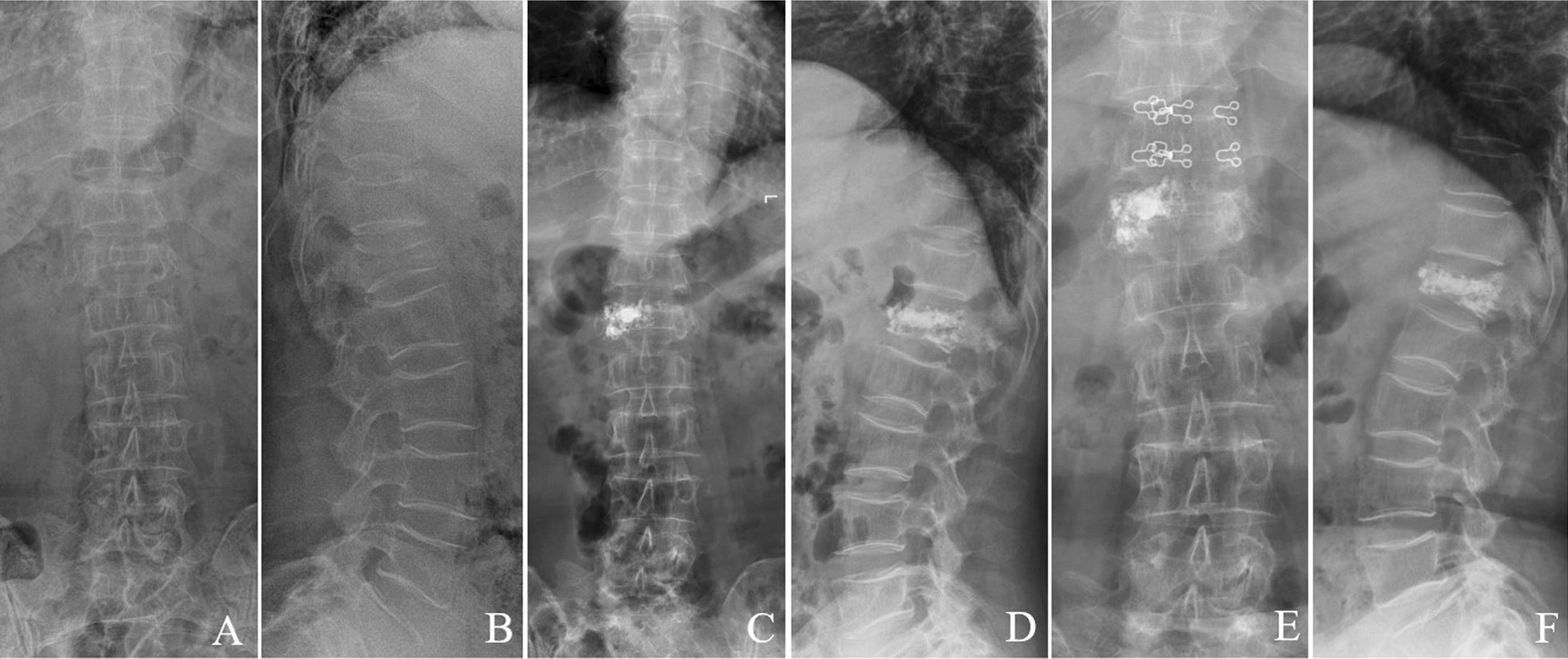 Fig. 9