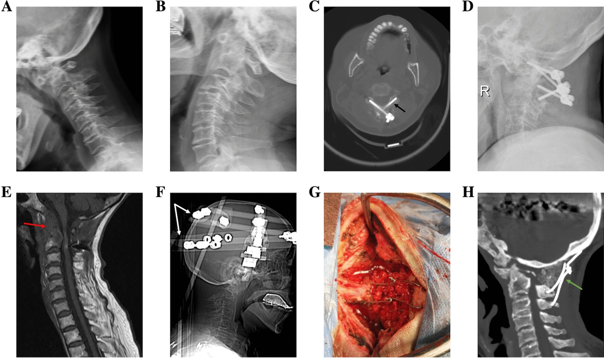 Fig. 6