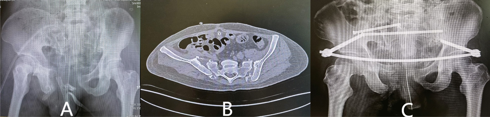 Fig. 3