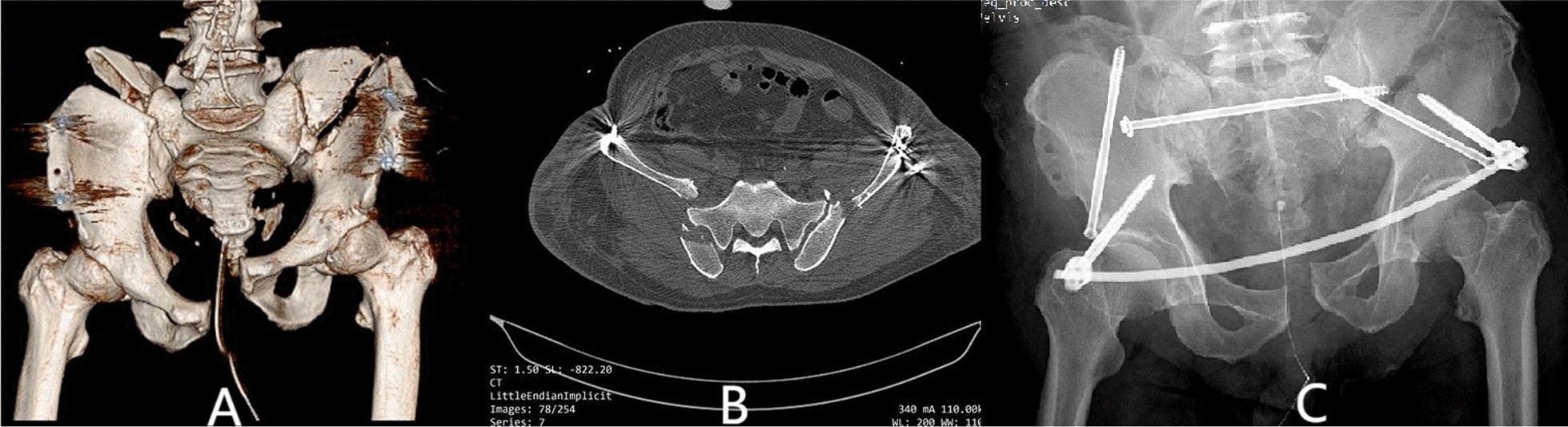 Fig. 6