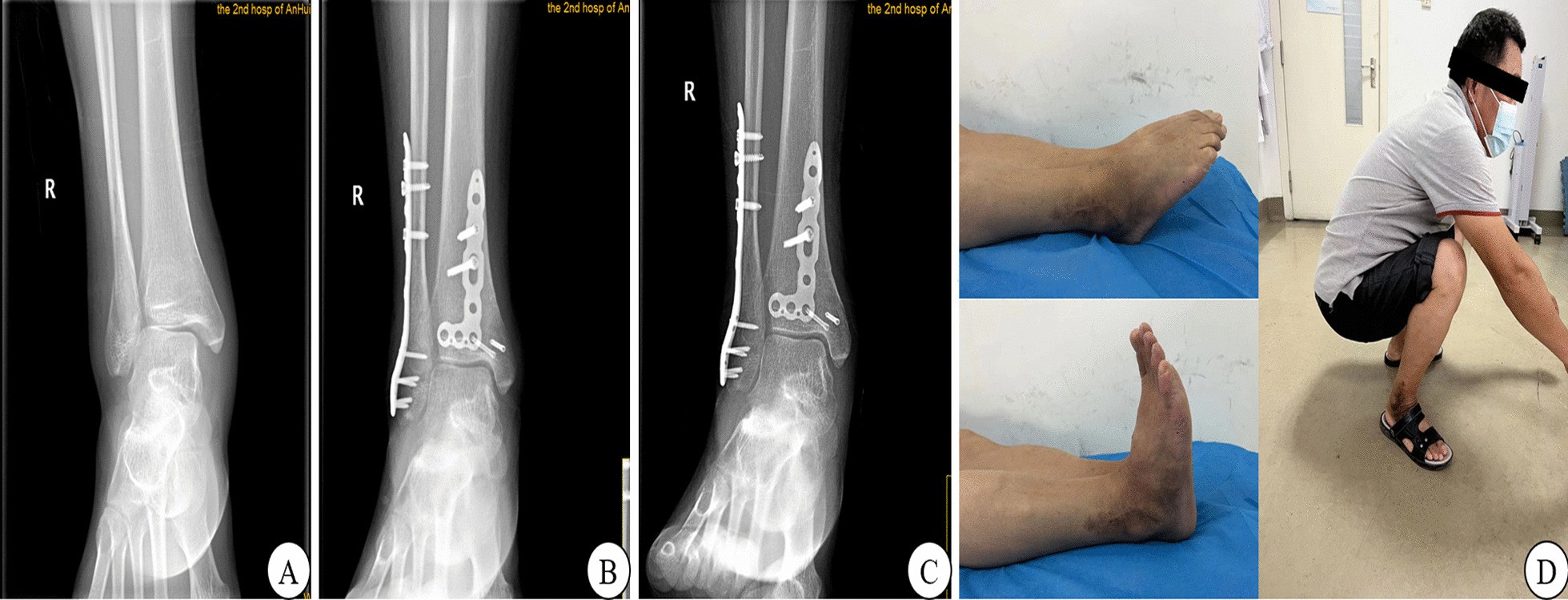 Fig. 3