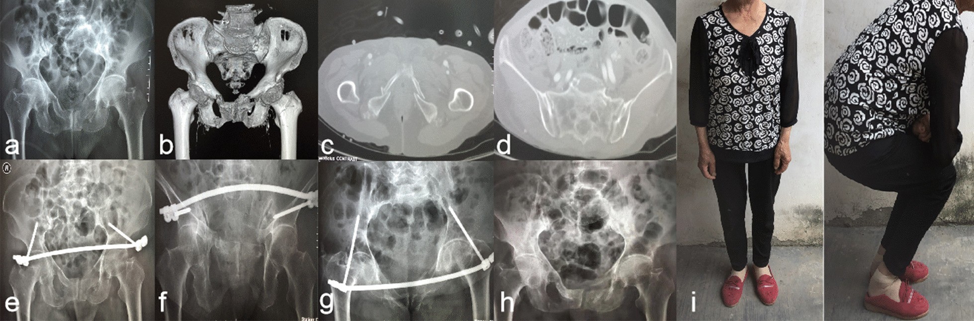 Fig. 1