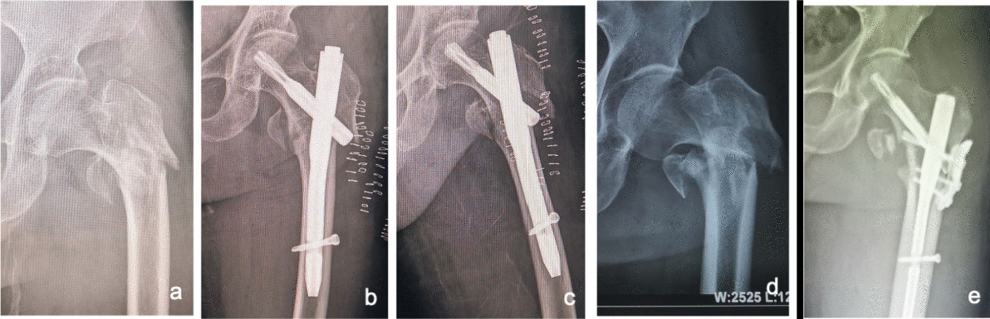 Fig. 13