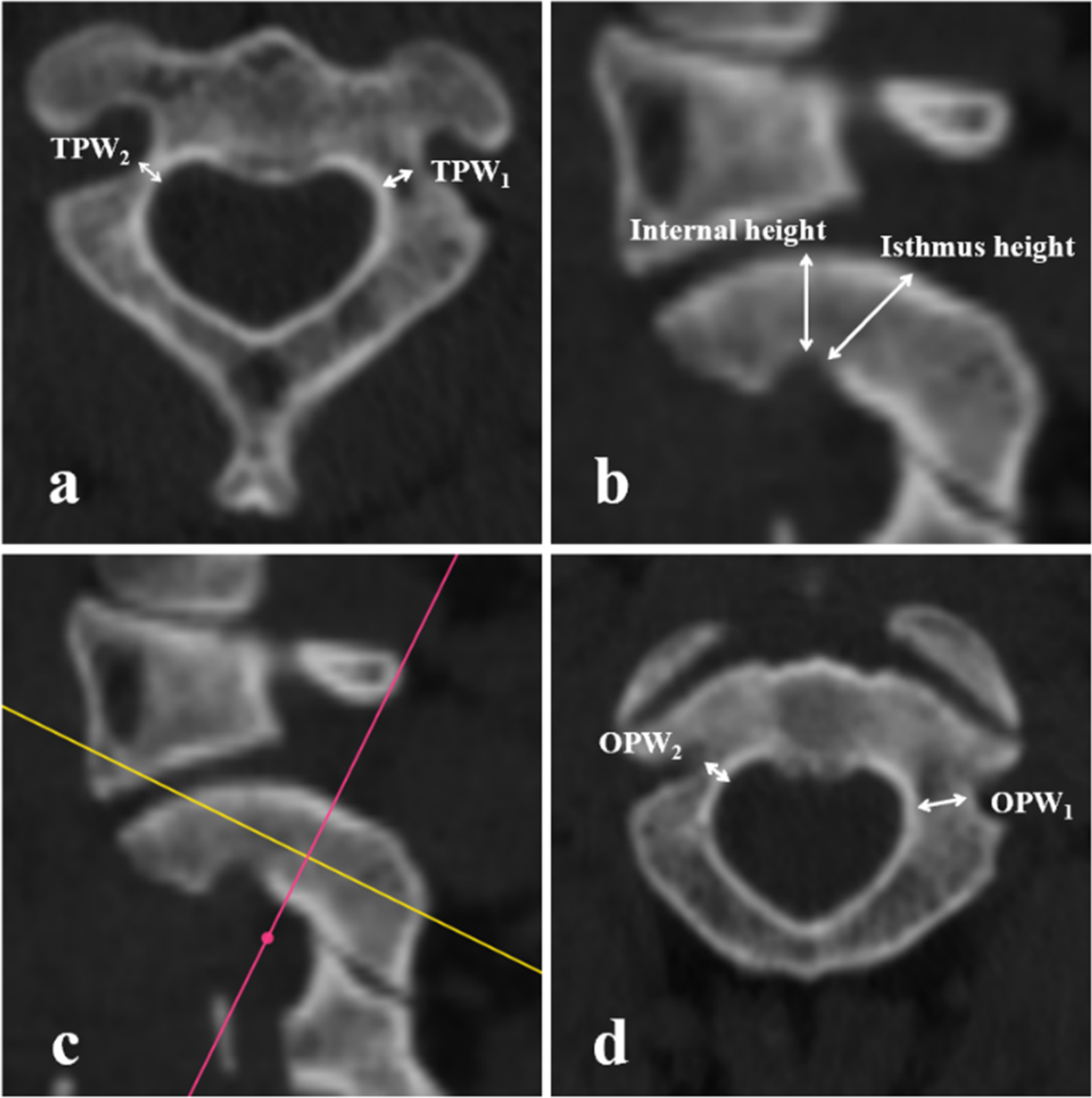 Fig. 1