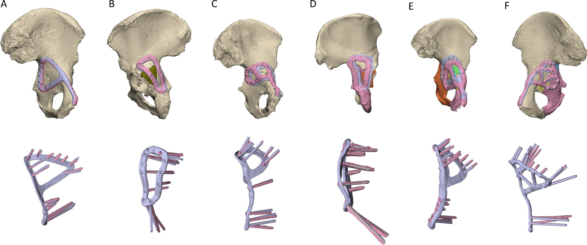 Fig. 12