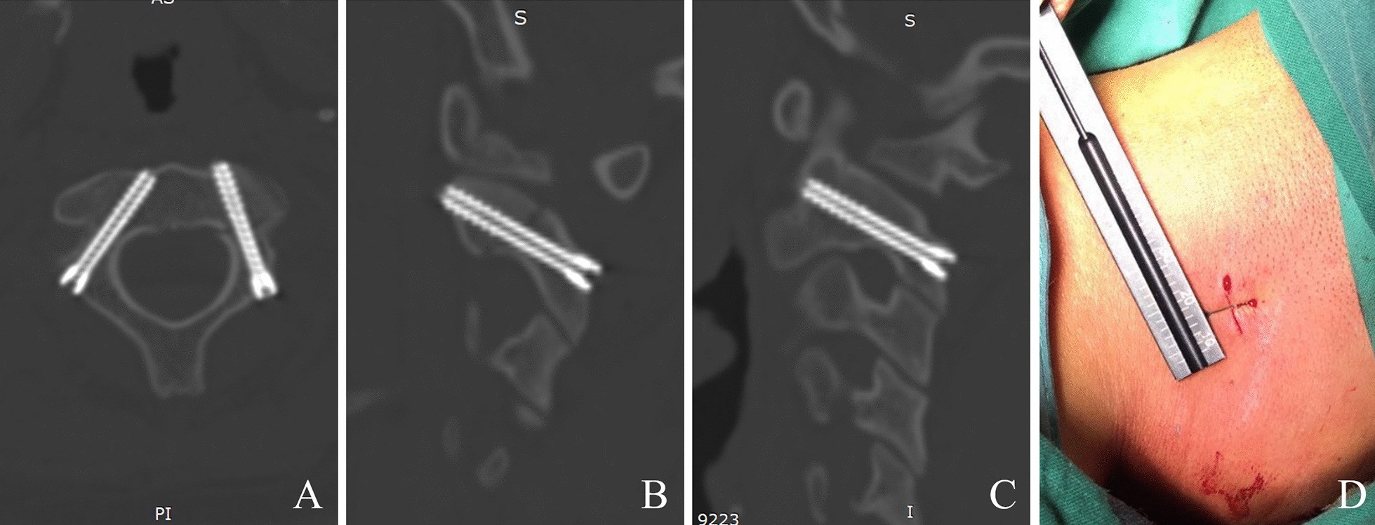 Fig. 4