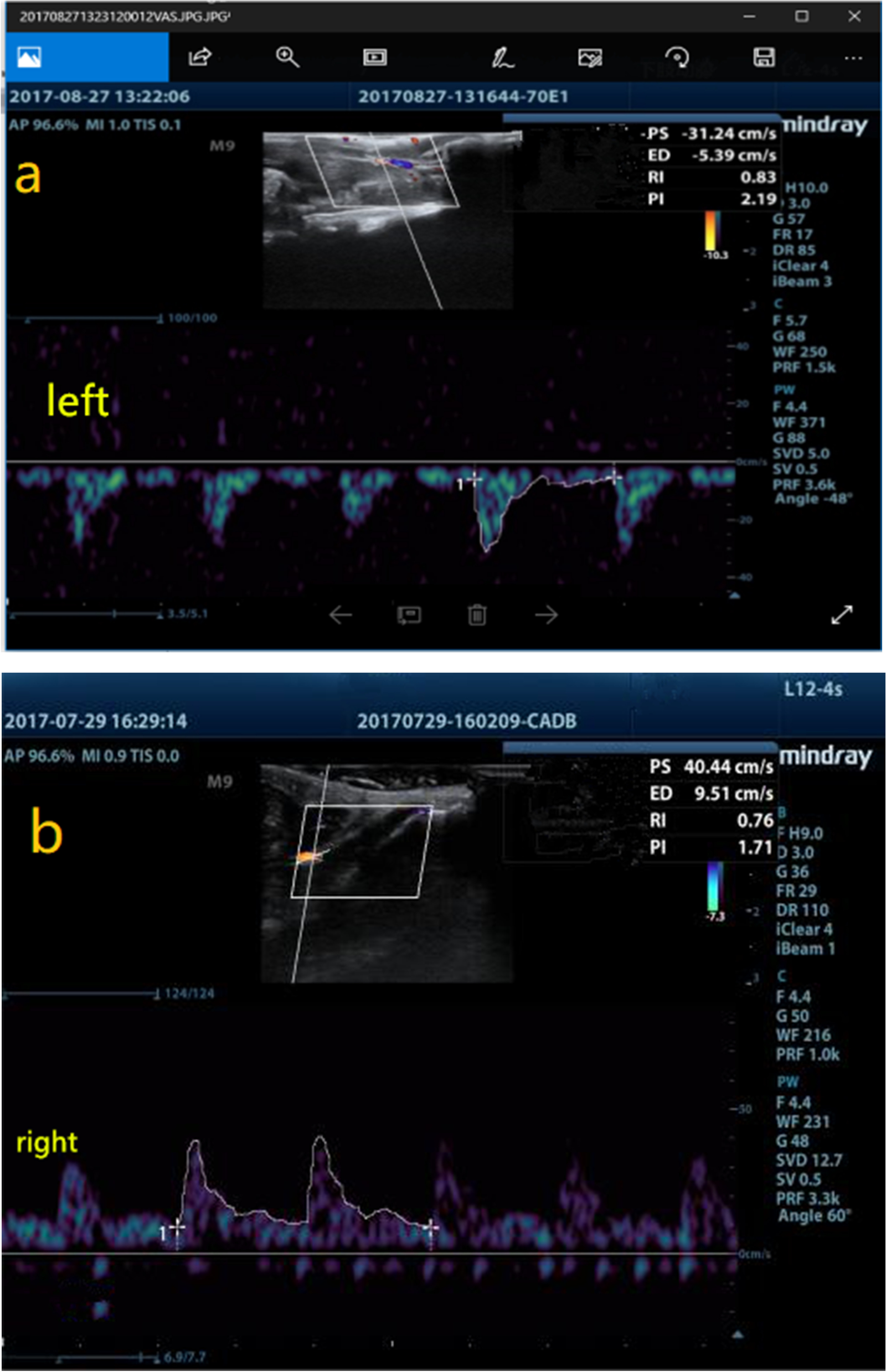 Fig.3