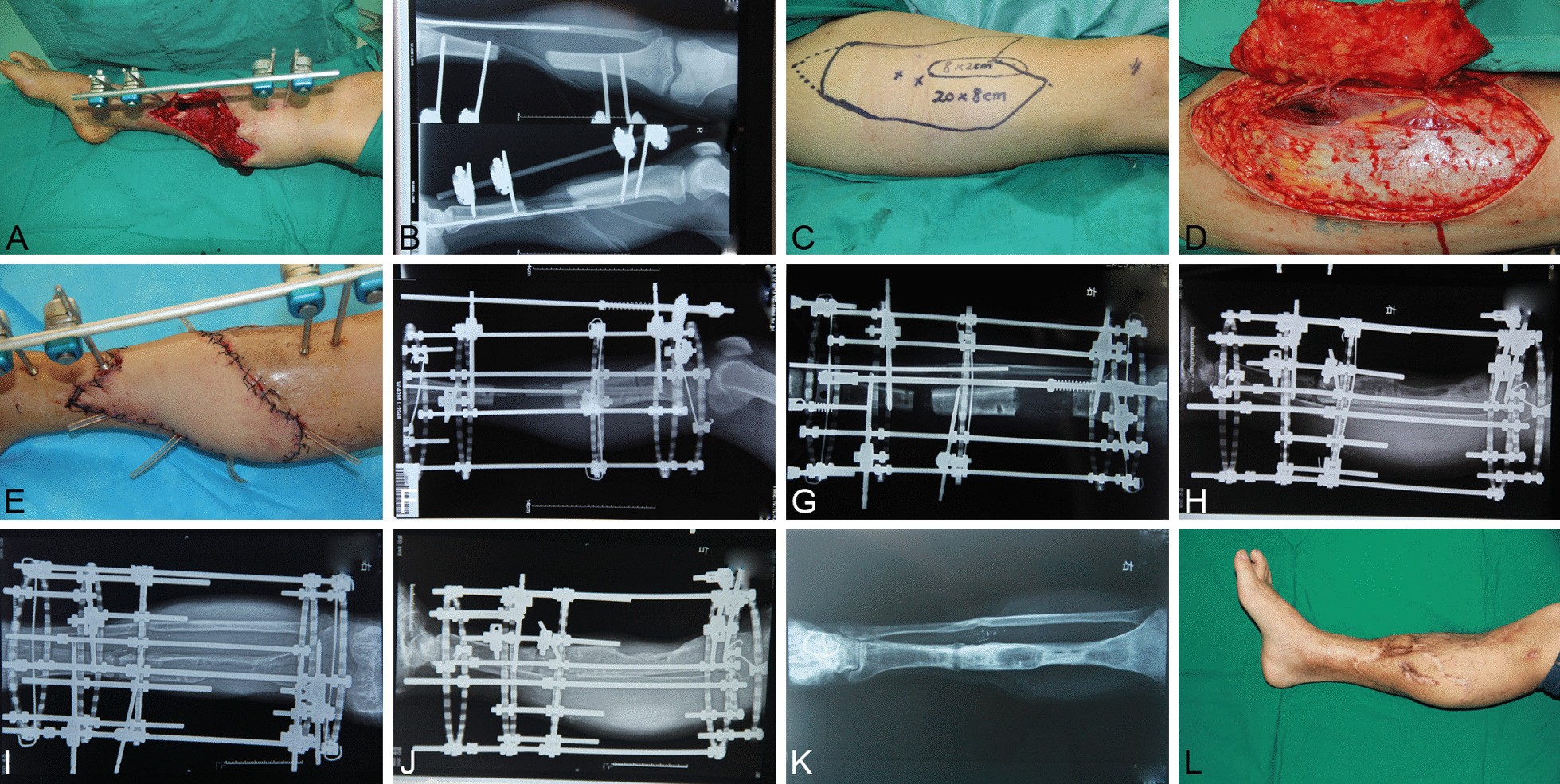 Fig. 2