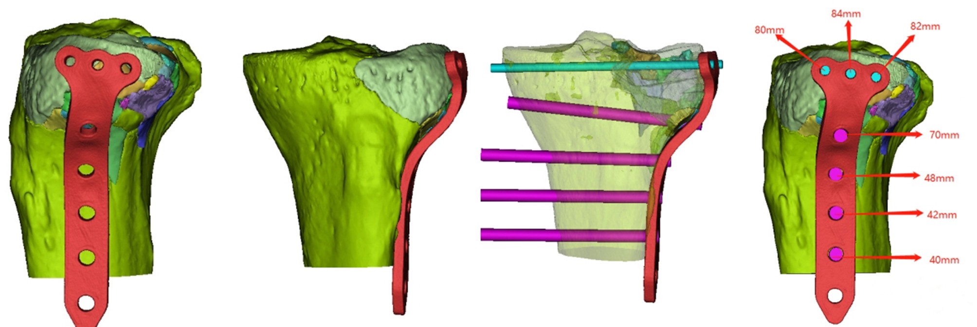 Fig. 9