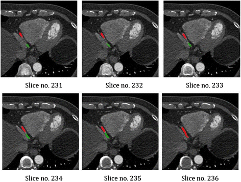 Figure 25