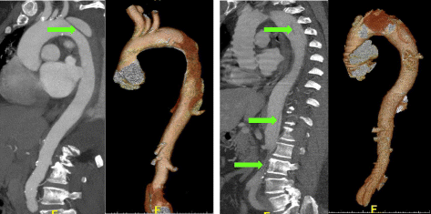 Fig. 8