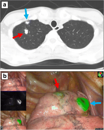 Fig. 5