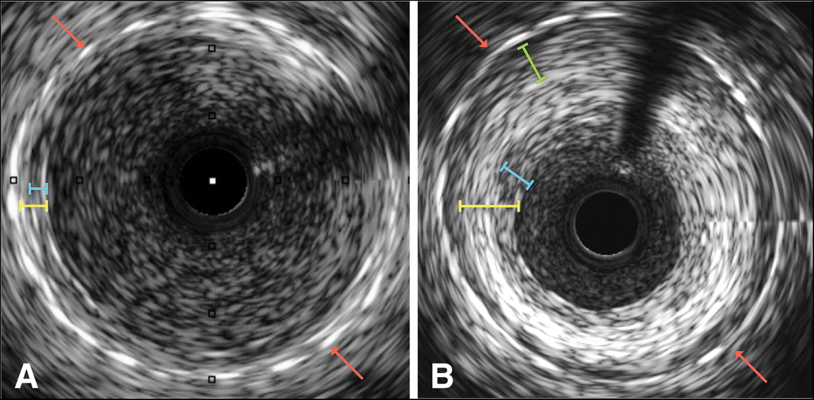 Fig. 5