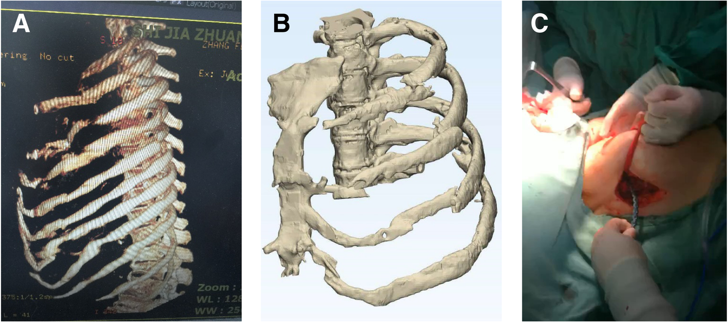 Fig. 3