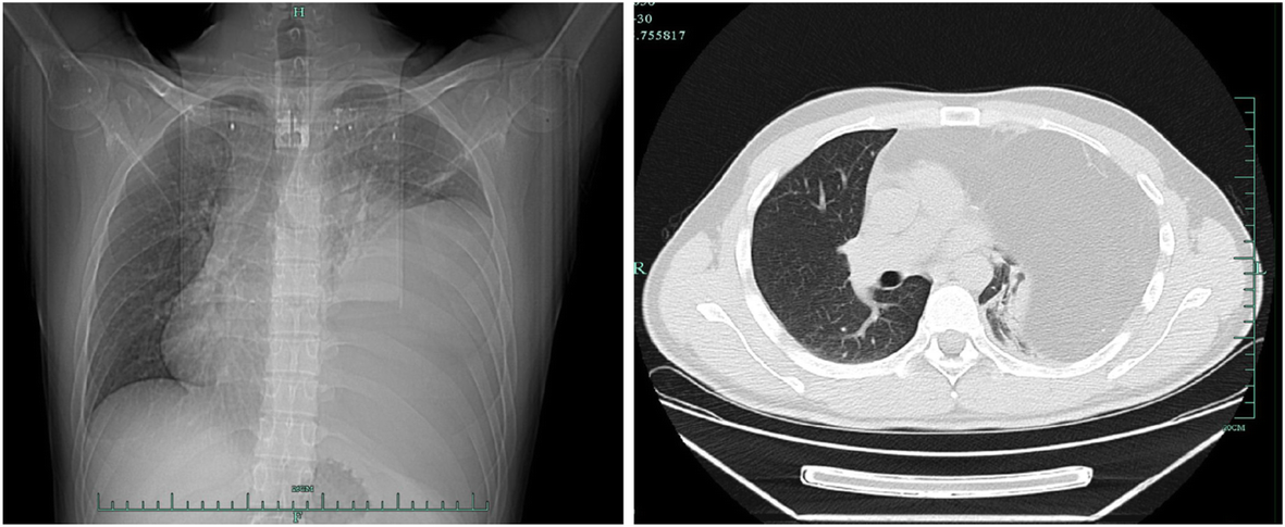 Fig. 1