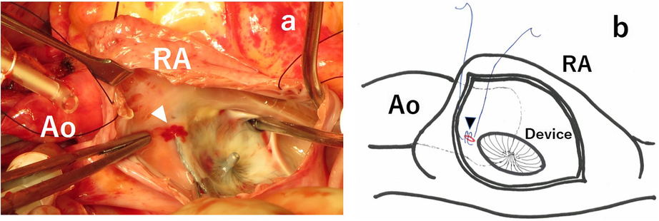 Fig. 4