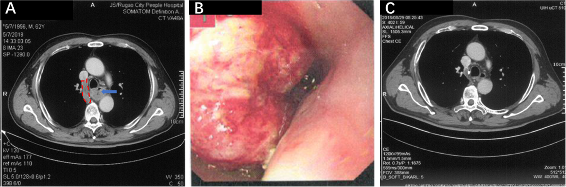 Fig. 1