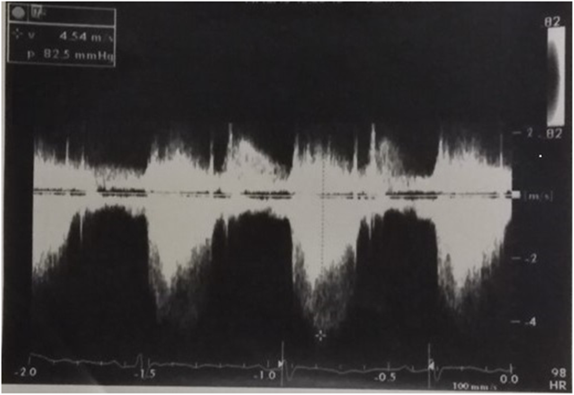 Fig. 2