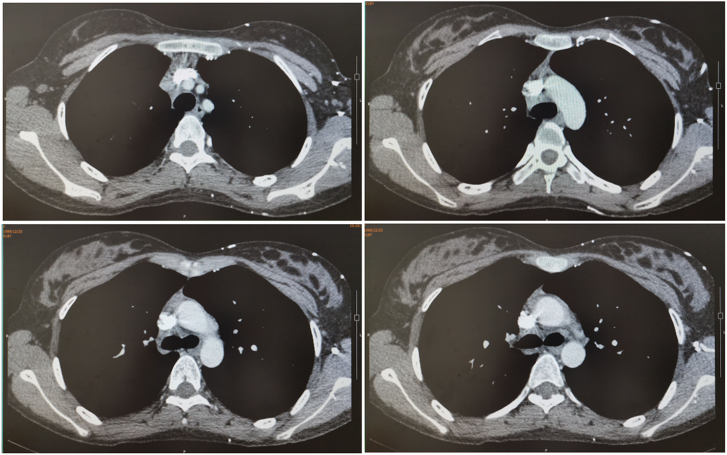 Fig. 6