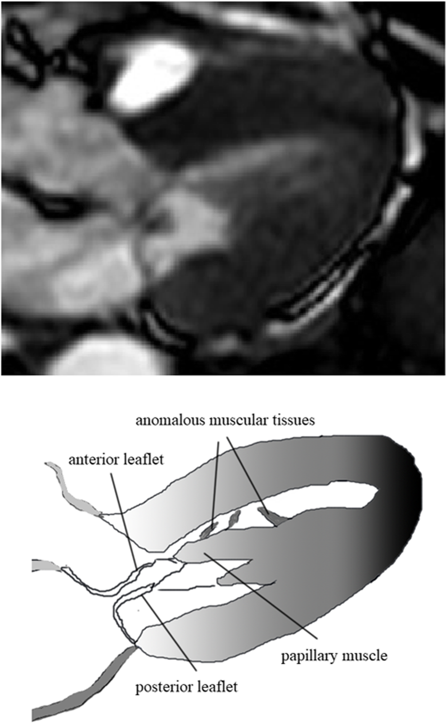 Fig. 2