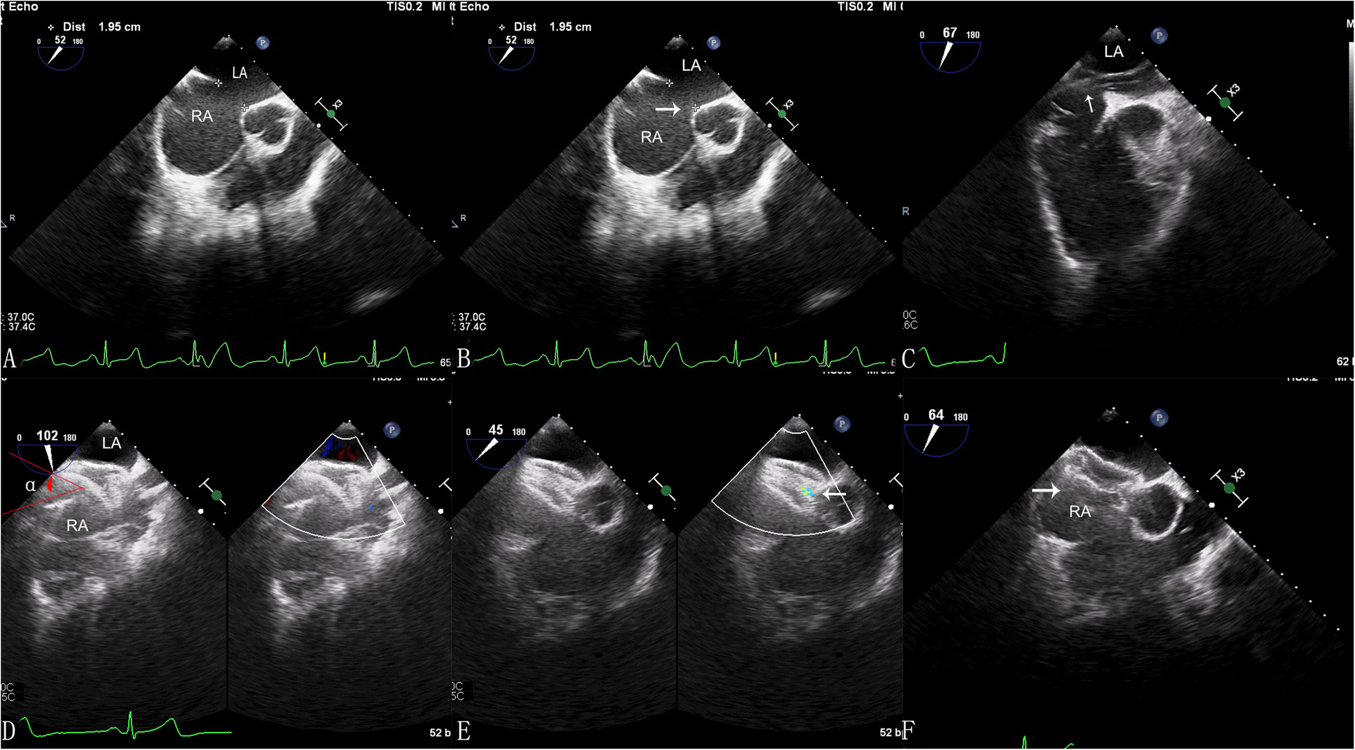 Fig. 2