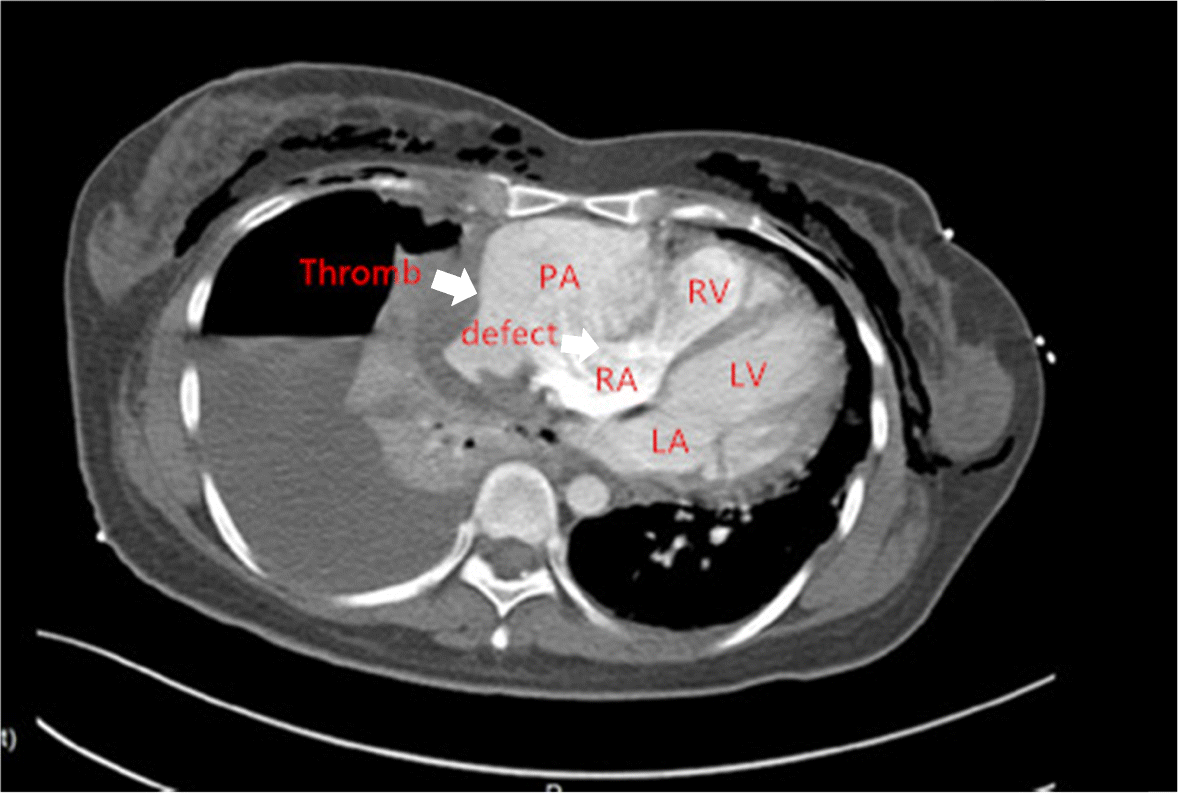 Fig. 2