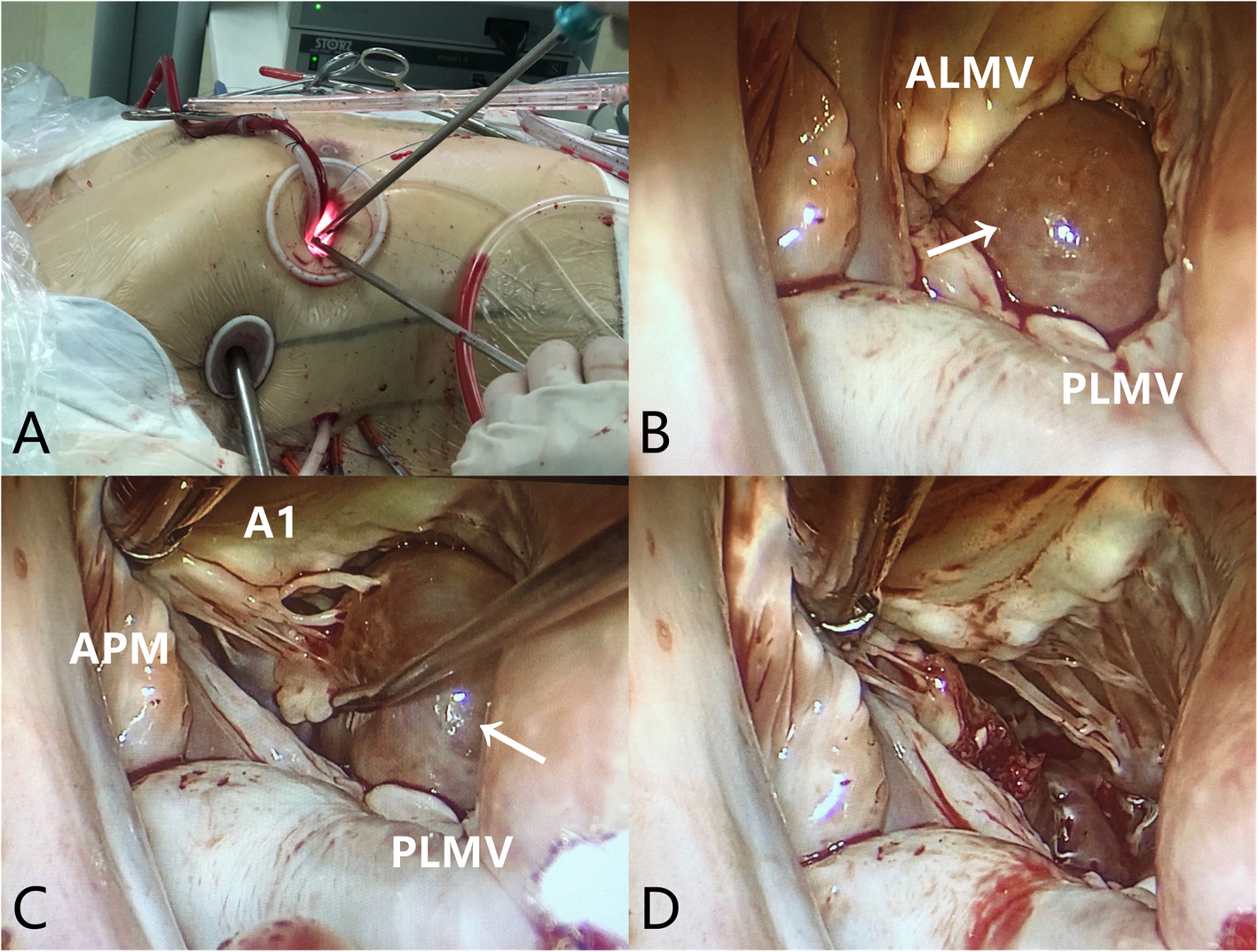 Fig. 2