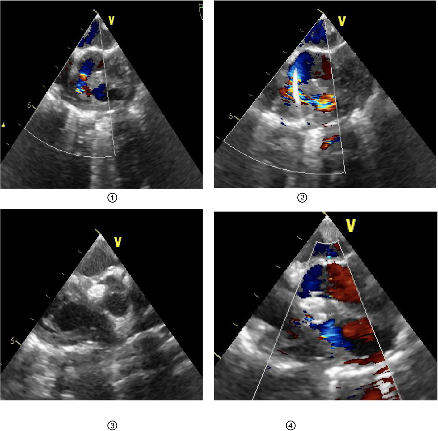 Fig. 3