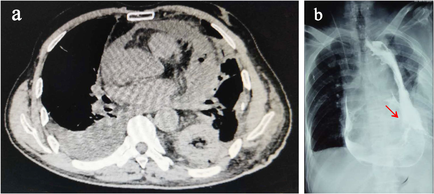 Fig. 2