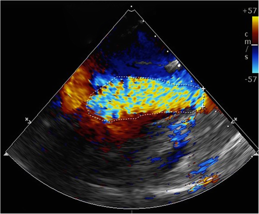 Fig. 2