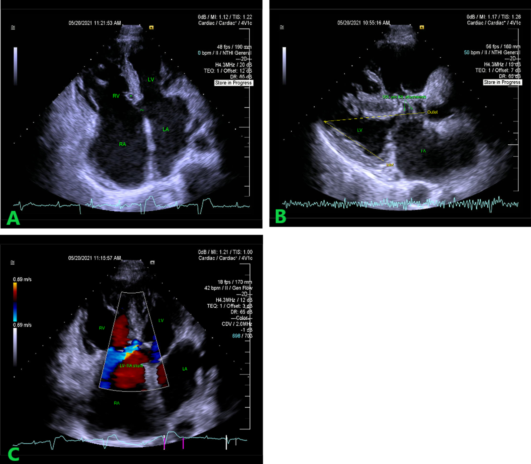 Fig. 1