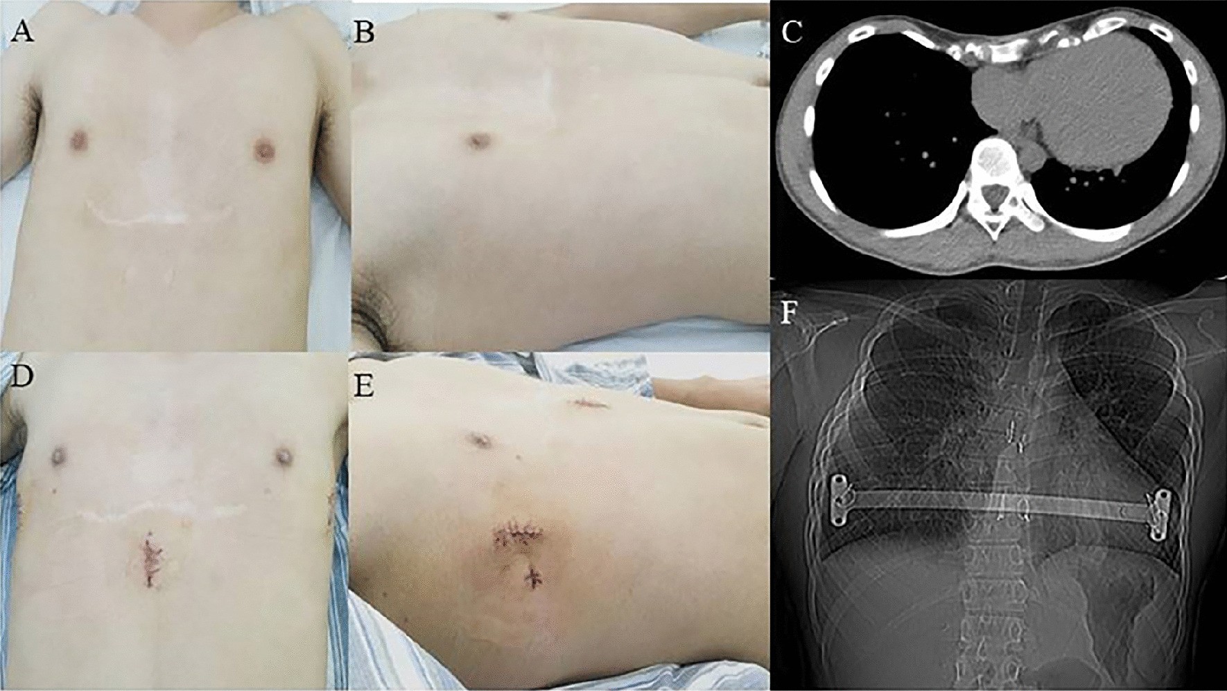 Fig. 2